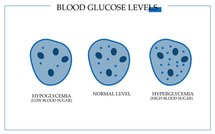 Differentiate between abrupt onset hypoglycemia and gradual onset hypoglycemia